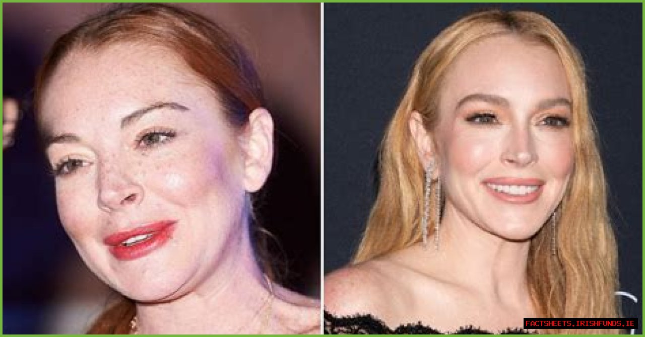 Unveiling The Secrets Of Lindsay Lohan's Nose Job: Discoveries And Insights